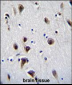 MeCP2 Antibody (N-term S80)